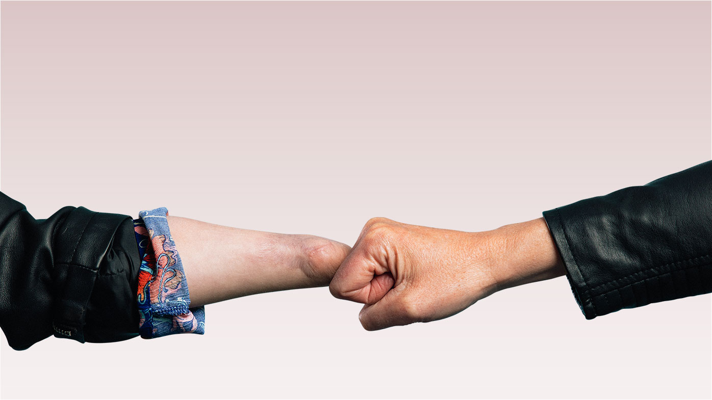 Amputated hand touching knuckles with five-finger hand