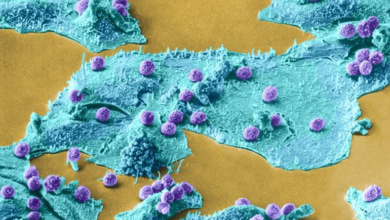  Exploring the Tumor Microenvironment