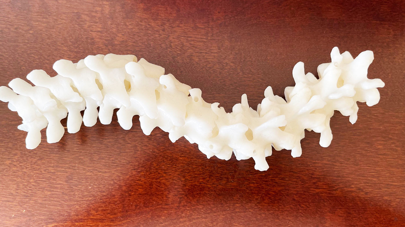 Emily's Spine model
